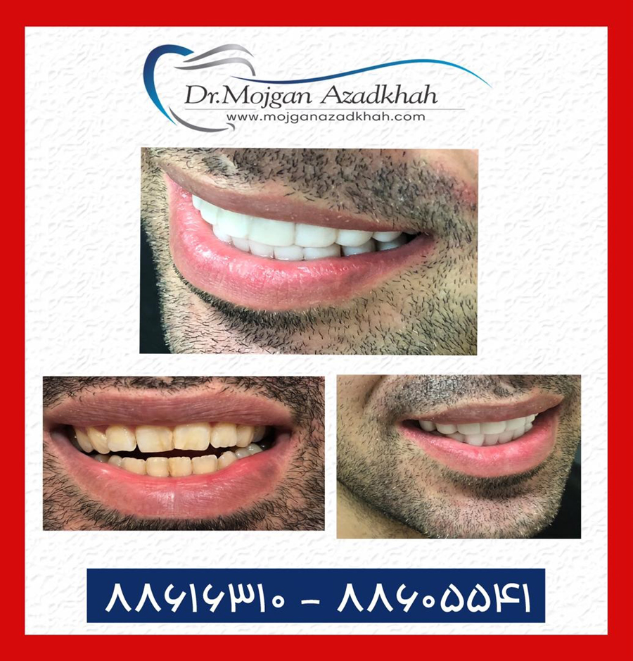 مژگان آزادخواه