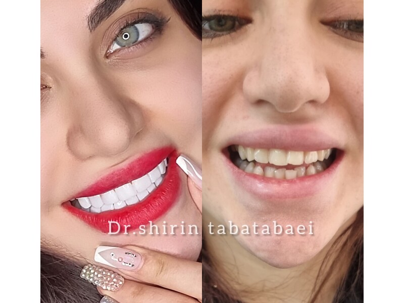 شیرین طباطبایی