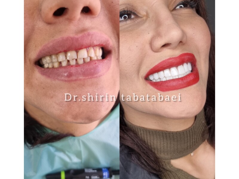 شیرین طباطبایی